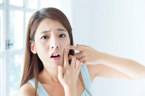 [한국일보] 여드름 스트레스 한 번에 날려..