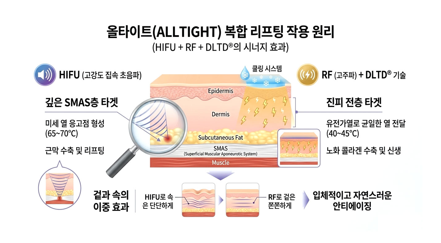 올타이트 HIFU+RF 복합 작동 원리