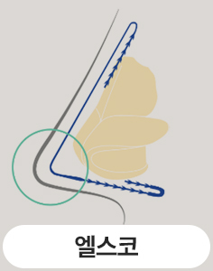미주코 엘스코 차이점