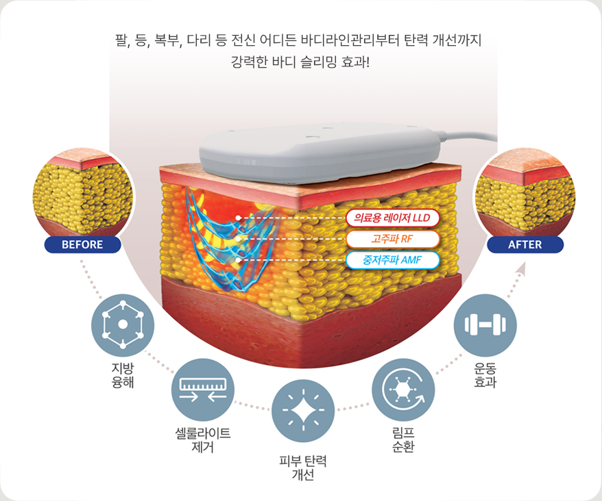 노블쉐이프